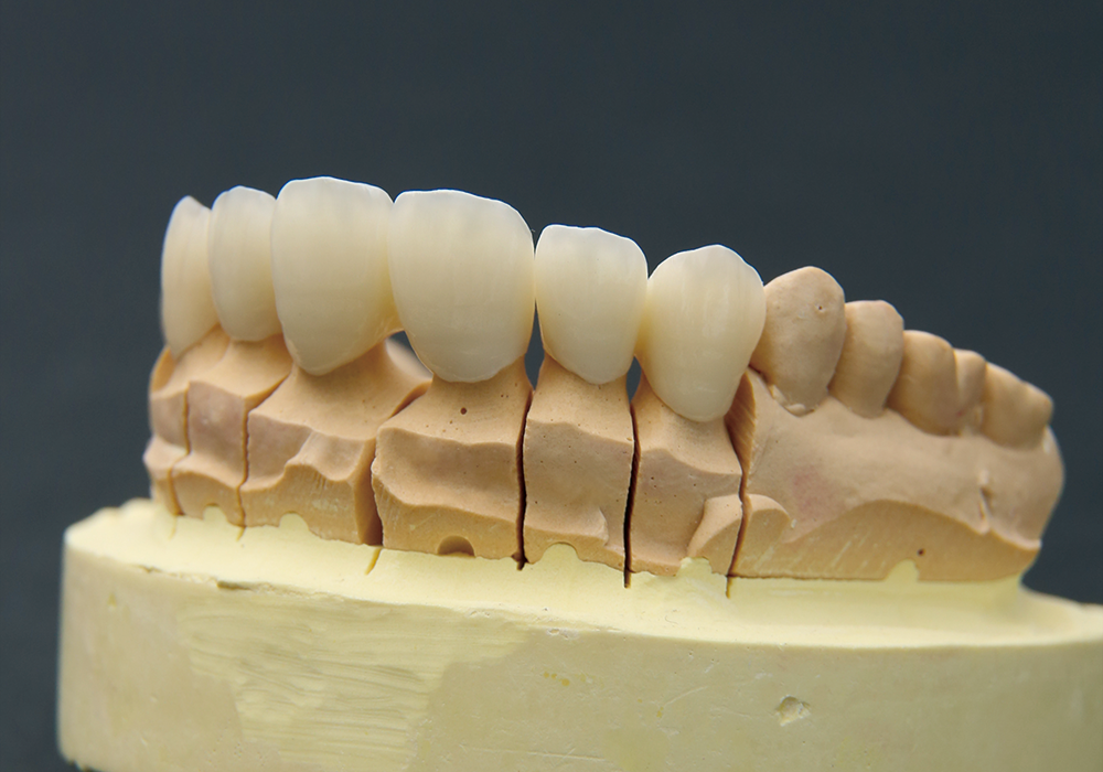 ジルコニアセラミック